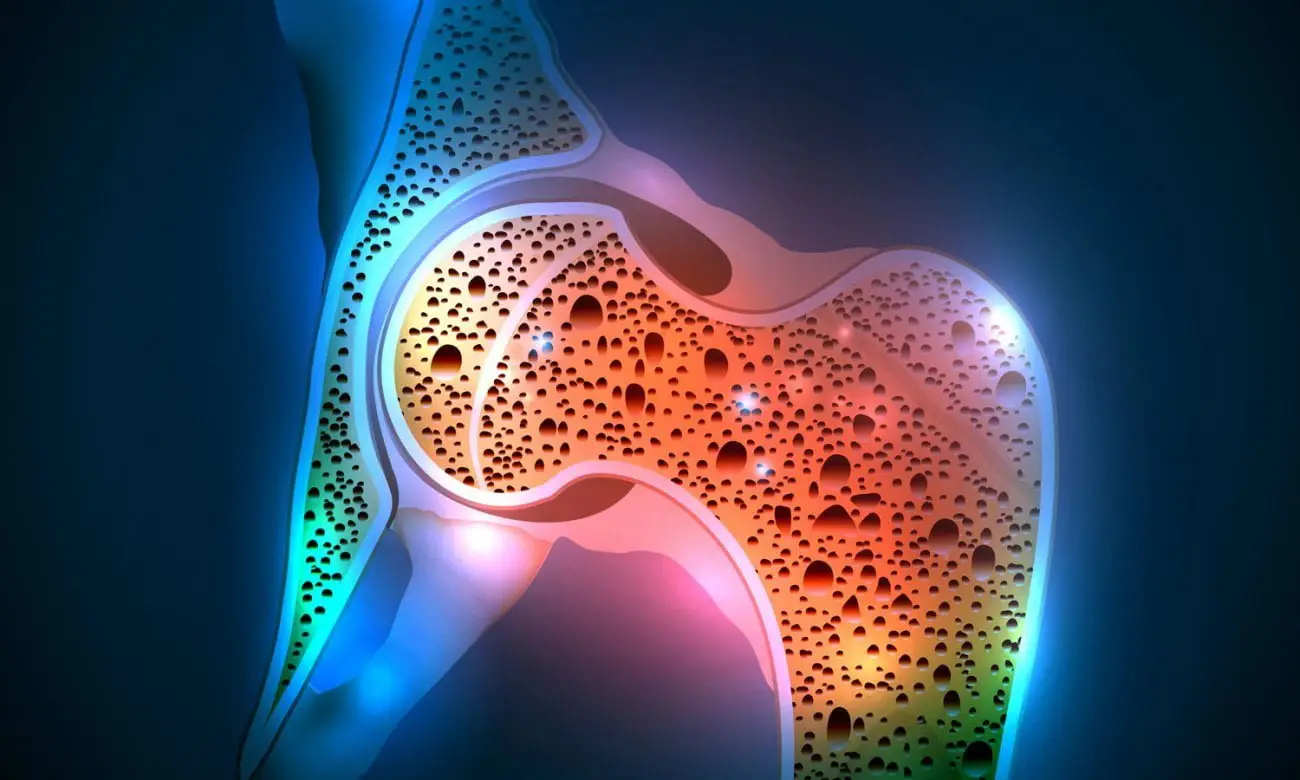 Hai l’osteoporosi: scopri subito quanto camminare per rinforzare le ossa secondo i medici