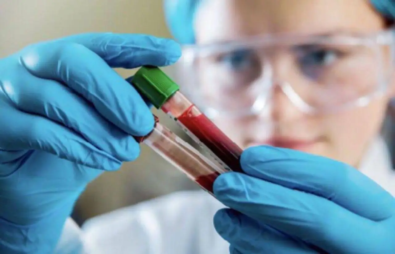 Hai fatto analisi del sangue senza digiuno: ecco le conseguenze che non tutti conoscono
