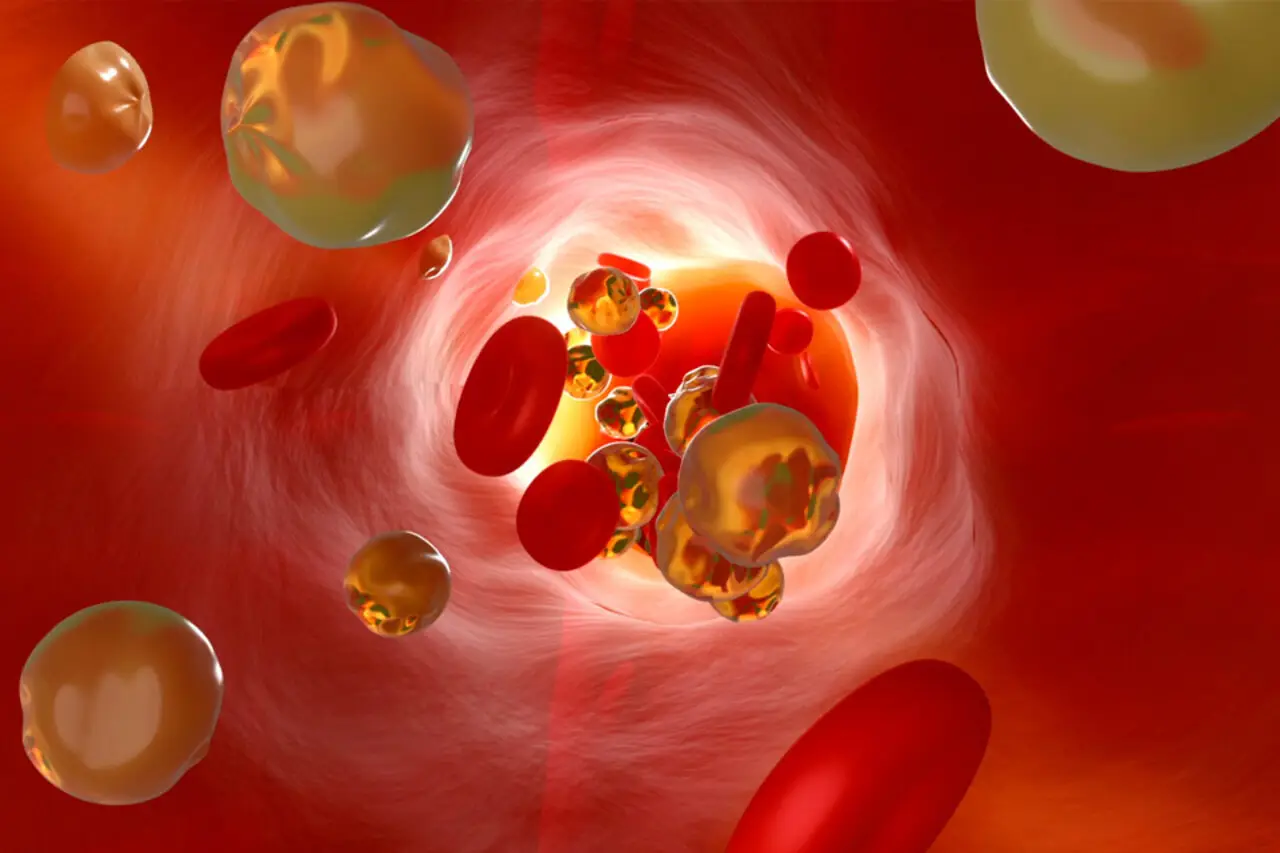 Le 5 malattie del sangue più comuni: ecco quali sono