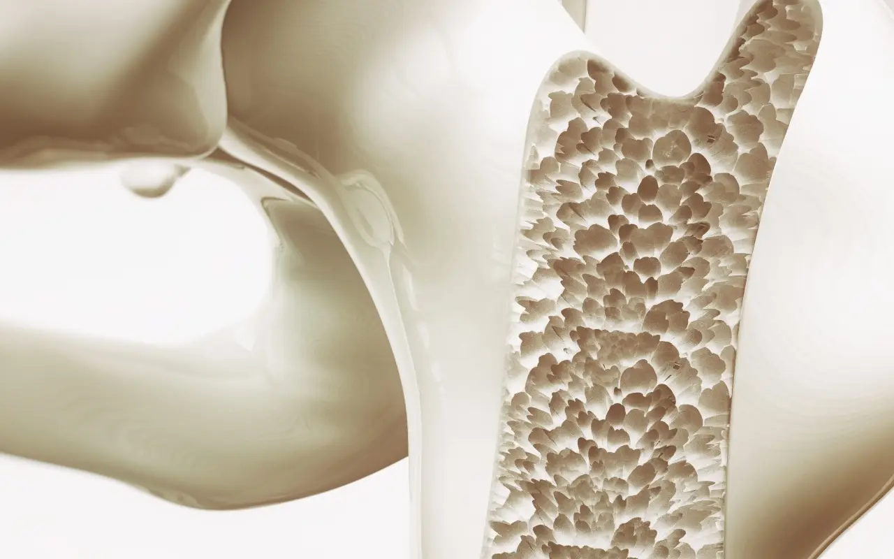 Sai oggi come si cura l’osteoporosi: ecco quanto dura davvero il trattamento